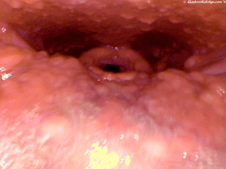 63 Photos<br />Super micro views inside Katelyn's mouth, down her throat, of her eyes, nose, and hands!